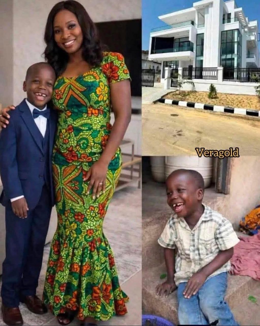The Boy Who Changed His Family’s Life with a Single Laugh