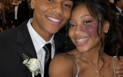 Only One Boy Asked Me to Prom Because No One Else Wanted to Due to the Birthmark on My Face – Everyone Laughed Until an Officer Walked Into the Hall