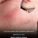 :A: woman’s chin hair is a sign of…See more