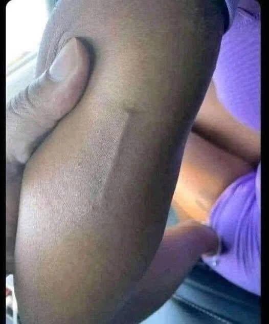 Found this in my girls arm still trying to figure out what it is