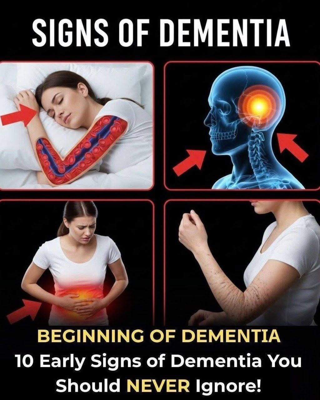 10 Early Signs of Dementia You Should NEVER Ignore!::A….