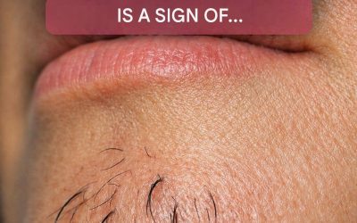 A woman’s chin hair is a sign of… See more