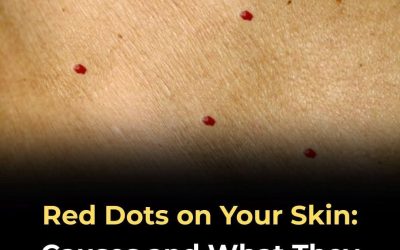 11 Possible Reasons for Red Dots on Your Skin