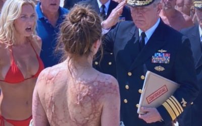 My sister ripped my shirt open on a luxury beach in front of Navy officers and laughed at the scars covering my back –