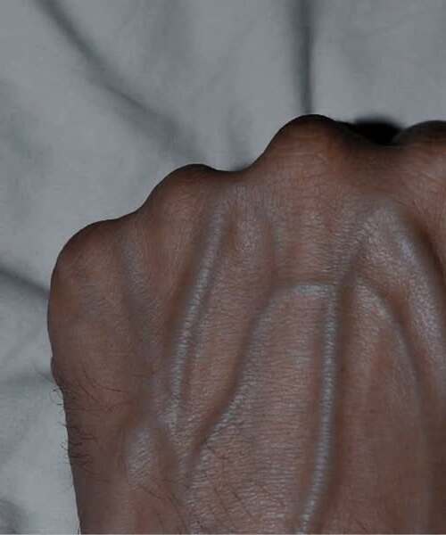 If the veins on your arm are visibly prominent, this is :A: signal that