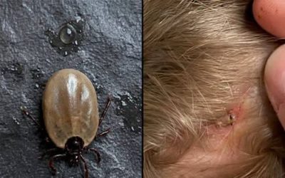 How to stay calm when you find unwanted “guests” in your child’s hair.