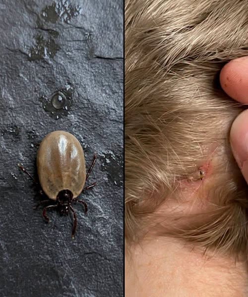 How to stay calm when you find unwanted “guests” in your child’s hair.