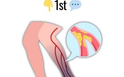 10 Warning Signs of a Blood Clot in the Leg You Should Know