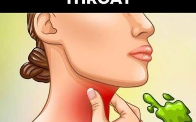 The Real Causes of Constant Phlegm and Mucus in Throat and How to Get Rid of It!