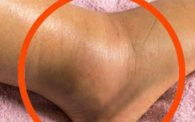 Ever Noticed That Tiny Hole on Your Nail Clipper? Here’s What It’s Actually For