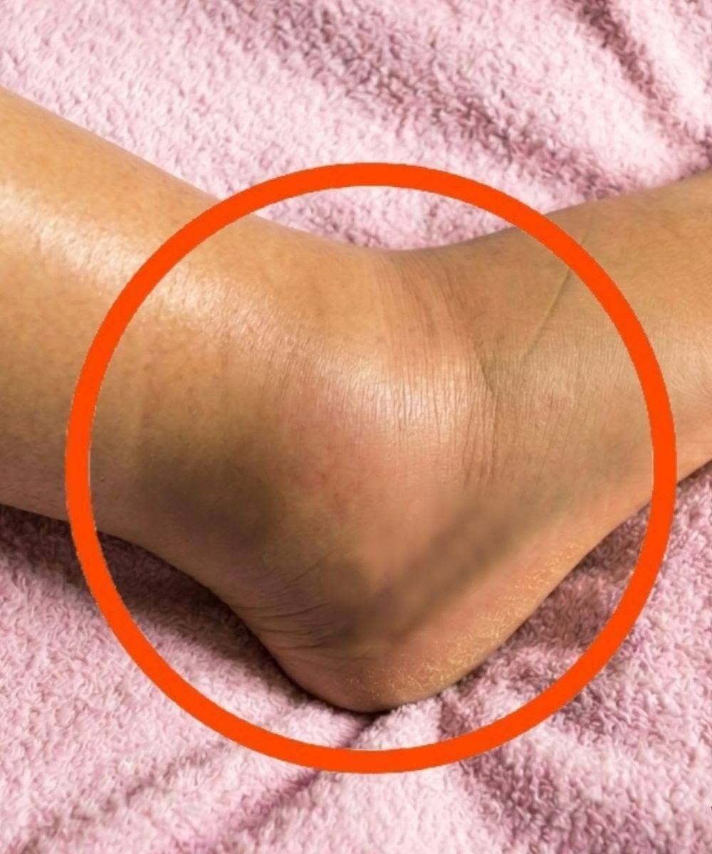 Ever Noticed That Tiny Hole on Your Nail Clipper? Here’s What It’s Actually For