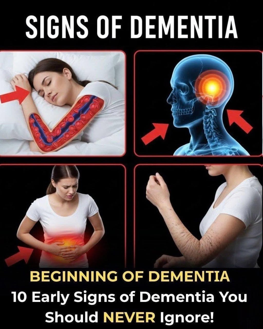 10 Early Signs of Dementia You Should NEVER Ignore!….
