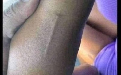 Found this in my girls arm still trying to figure out what it is