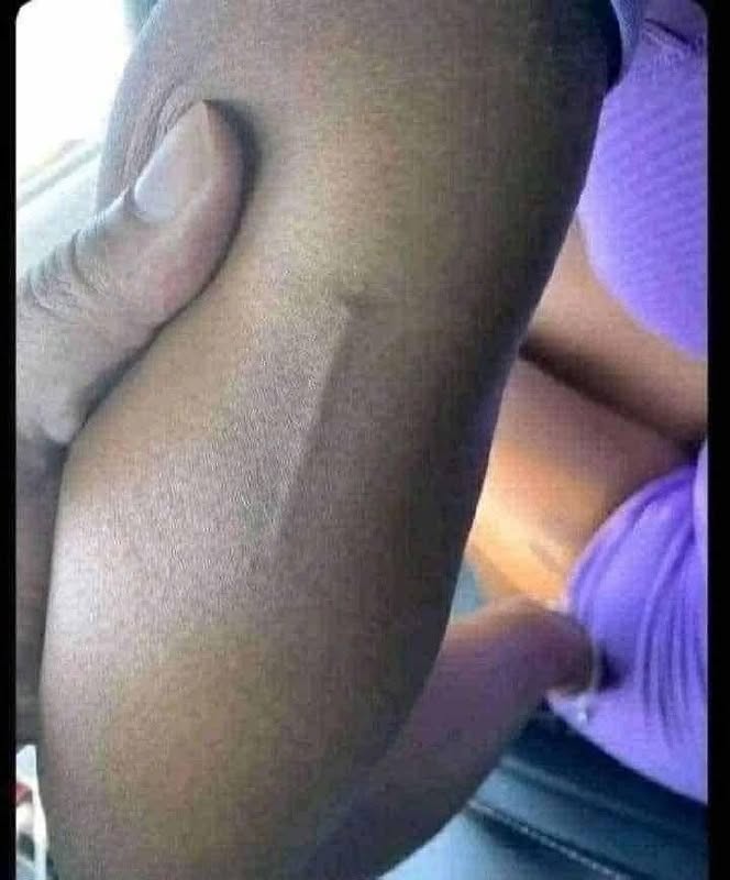 Found this in my girls arm still trying to figure out what it is