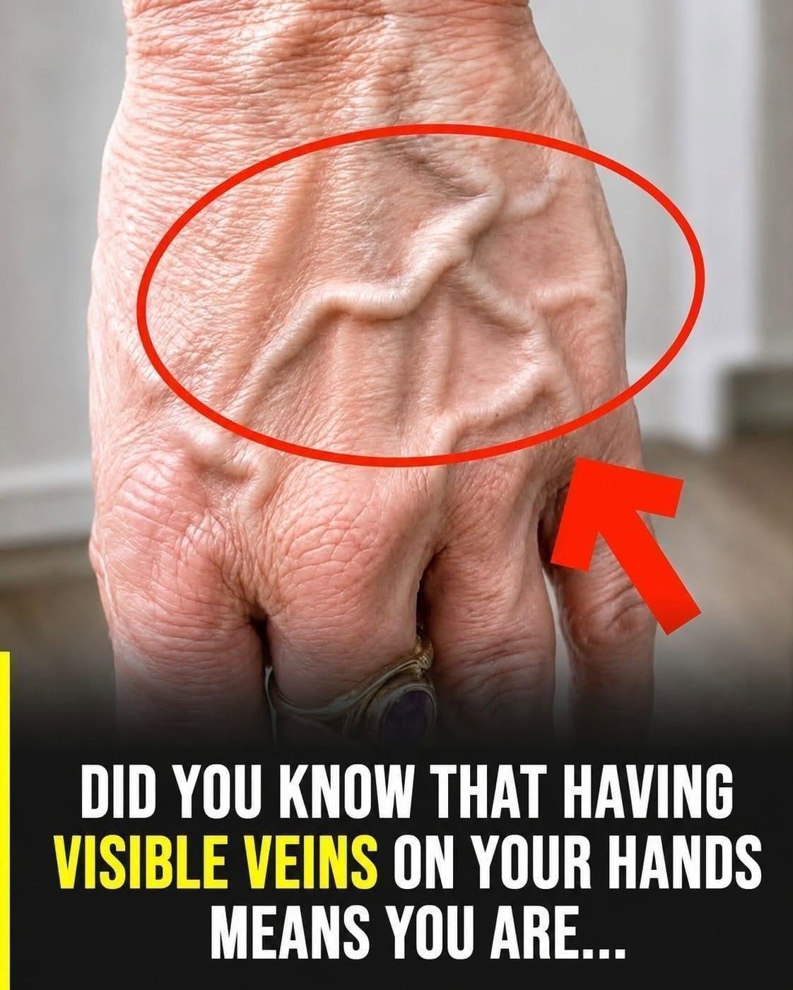 Did you know that having visible veins means you are… See more
