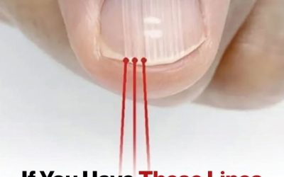 If You Have These Lines on Your Nails After 40, It’s a Clear Sign That…