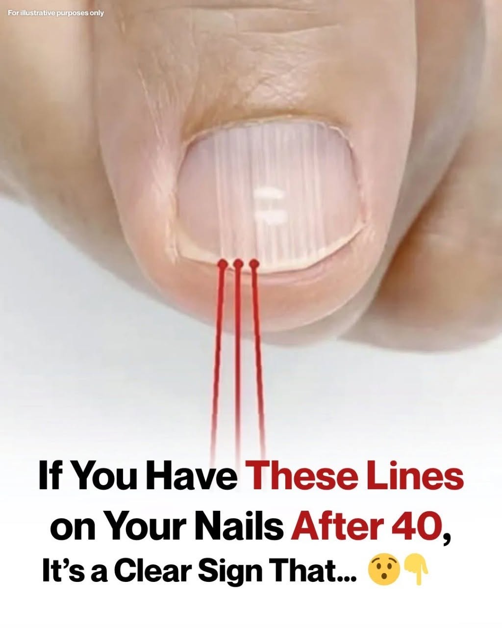 If You Have These Lines on Your Nails After 40, It’s a Clear Sign That…