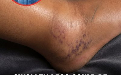 If you notice your legs are swollen, that’s a sign of ca… See more
