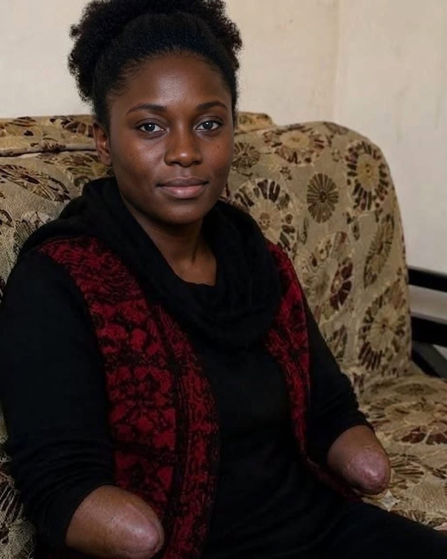 At 21 years old, my husband took me to a field and cut off both of my hands… But what happened afterward made an entire country remember my name.