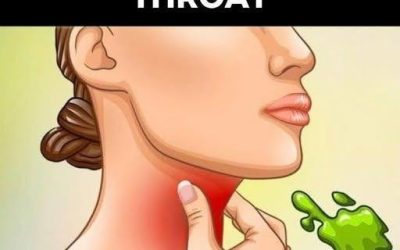The Real Causes of Constant Phlegm and Mucus in Throat — And How to Get Rid of It