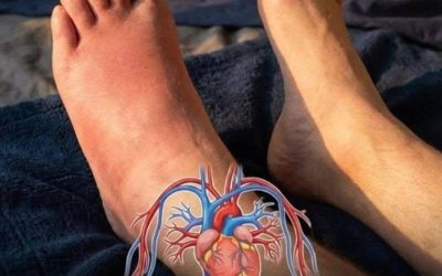7 Wa:rning Signs in Your Arms and Legs That Could Signal a Heart Att:ack1